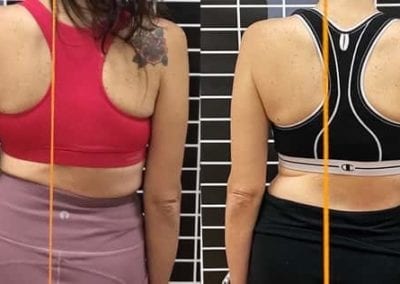 rita miller scoliosis therapy in boise idaho